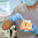 Main reasons Why People Proceed Abroad For Dental Implants